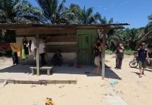 Citra Tutup Usia, Bocah 8 Tahun yang Diserang Gajah di Rumbai