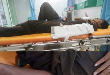 Kecelakaan Kerja, Tangan Pekerja Tergilas Konveyor di Pabrik CPO PT IMT